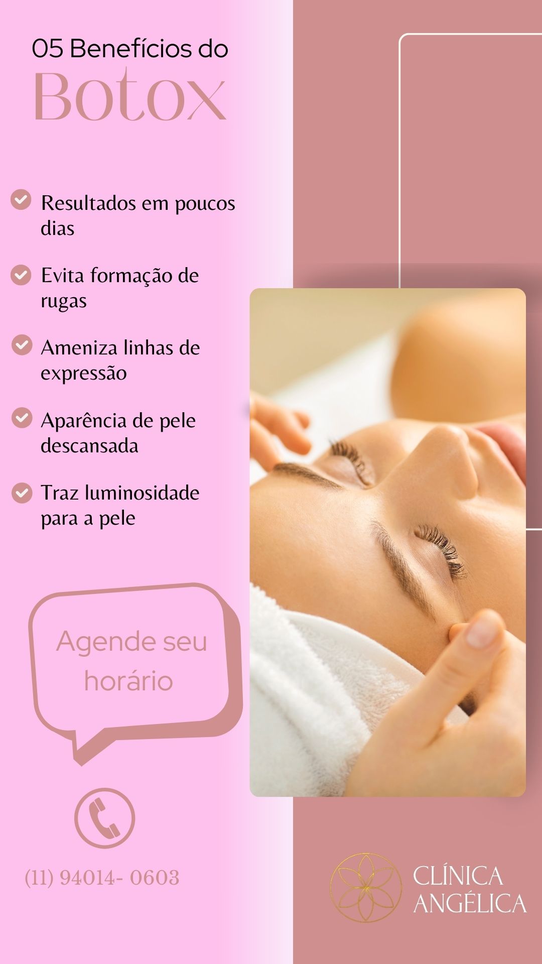 Beneficios_ToxinaBotulinica